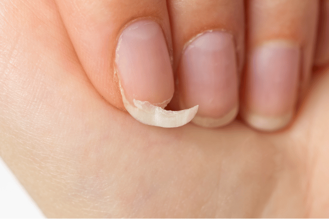 faire pousser ses ongles rongés