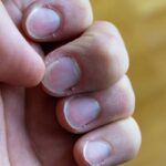 Comment arrêter de se ronger les ongles sans vernis amer